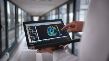 Mesterséges intelligencia segíti a stroke-betegek kezelését Magyarországon