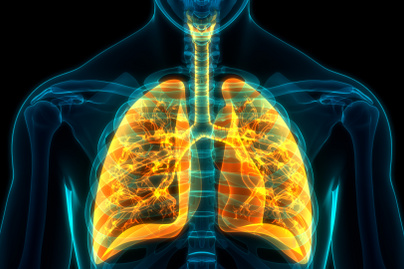 Tüdőtágulást is jelezhet a folyamatosan visszatérő hörghurut - Ilyen esetben kell orvoshoz fordulni