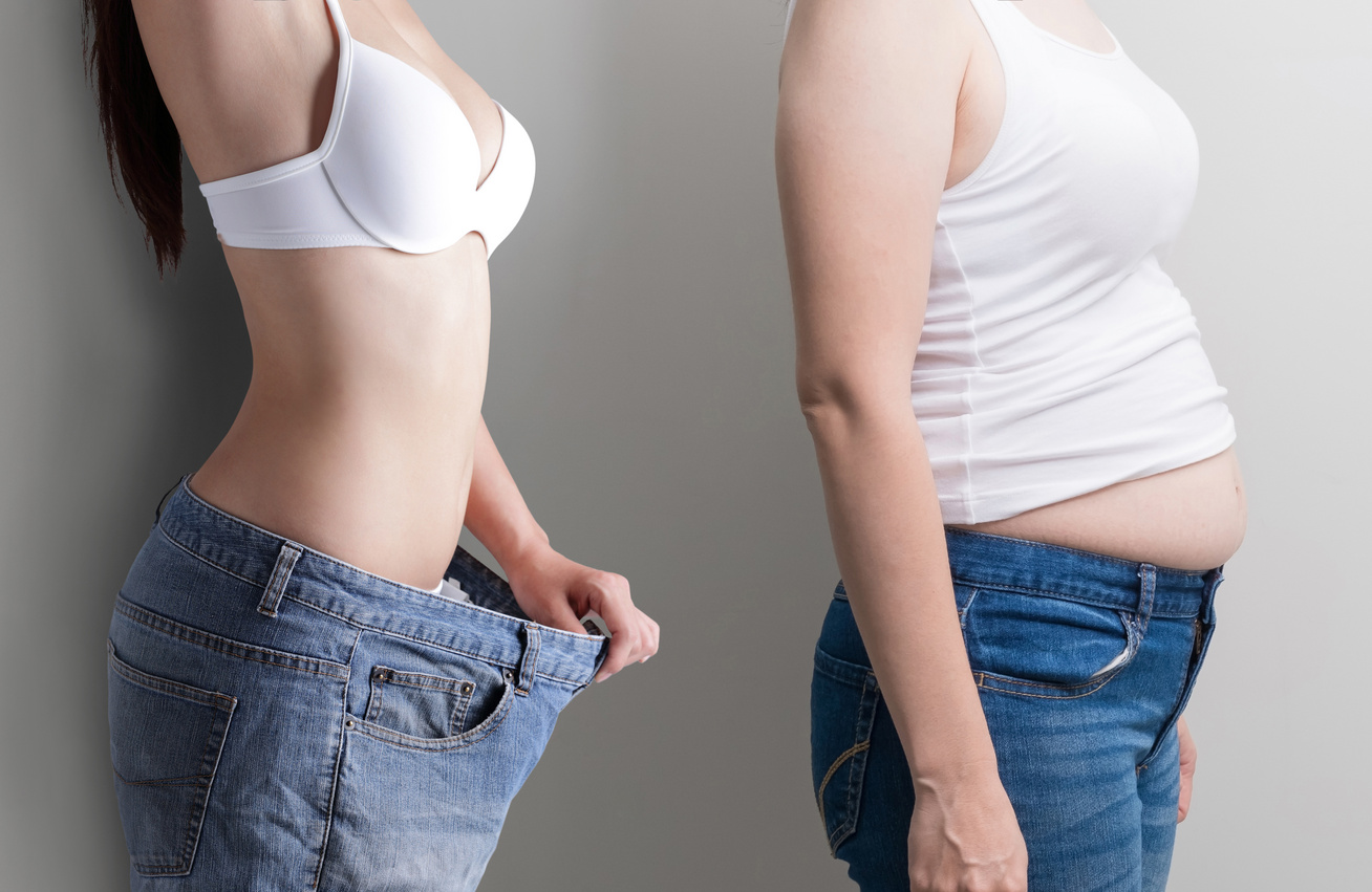 fogyás kórosan elhízott nőnél