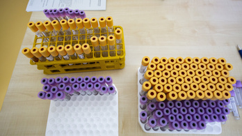 Elsőként az Szegedi Tudományegyetem használhatja a koronavírus elleni vadonatúj gyógyszert