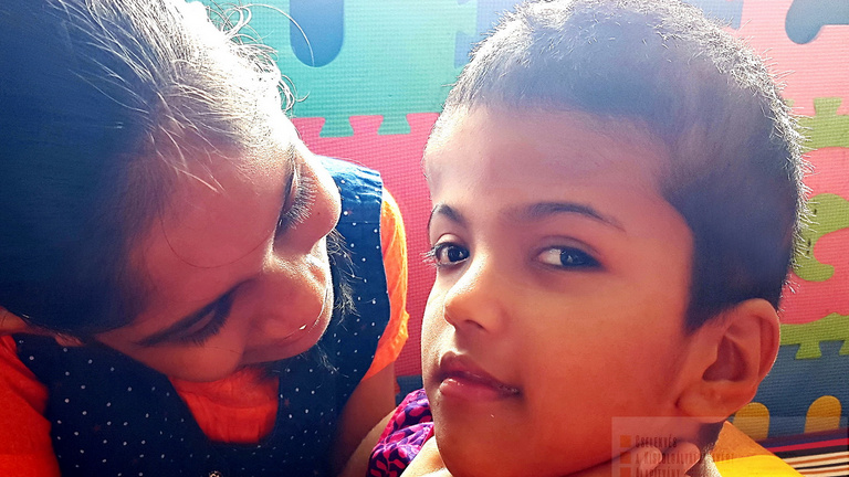 Újabb műtétet hajtott végre a magyar orvoscsoport a bangladesi sziámi ikrekért