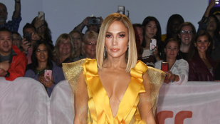 Jennifer Lopez azt állítja, sosem botoxoltatott