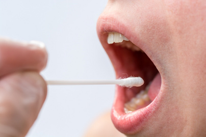 6 ráktípus, ami a szájüregben alakul ki: így zajlik a kezelésük