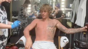 Justin Bieber alsógatyában mutatta meg, hogyan tüntetik el a tetoválásait