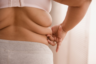 A leggyakoribb tévhitek az elhízásról: a több mozgás, kevesebb kalória nem mindig jelent megoldást