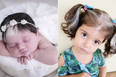 Különleges hajjal született a kislány: ősz tincsével meglepte a kórházi dolgozókat is
