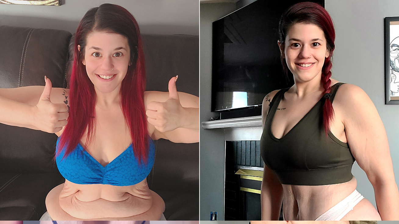 fogyás előtt és után a nők egészsége)