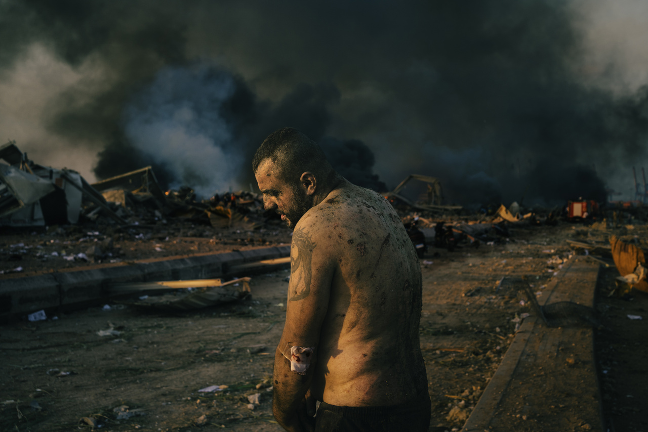 Lorenzo Tugnoli sorozatából: egy sérült férfi, a bejrúti robbanás közelében, a raktárépületek oltása közben.