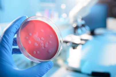 Sokan már antibiotikum-rezisztens baktériumokkal fertőződnek meg: magyar kutatók új modellt dolgoztak ki ellenük