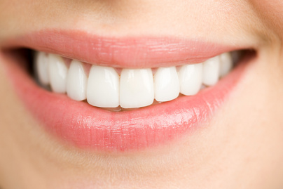 4 hatékony házi fogfehérítő, amivel látványos hatást érhetsz el: kíméletesen teszik szebbé a fogakat