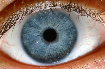Súlyos betegséget okozhat az emelkedett szemnyomás: 7 dolog, amit ismerni kell a szem egészsége érdekében
