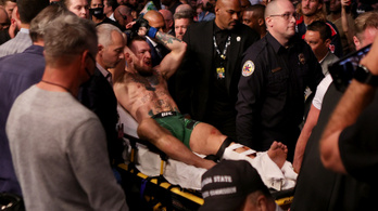 Brutális sérülés, hordágyon vitték el Conor McGregort