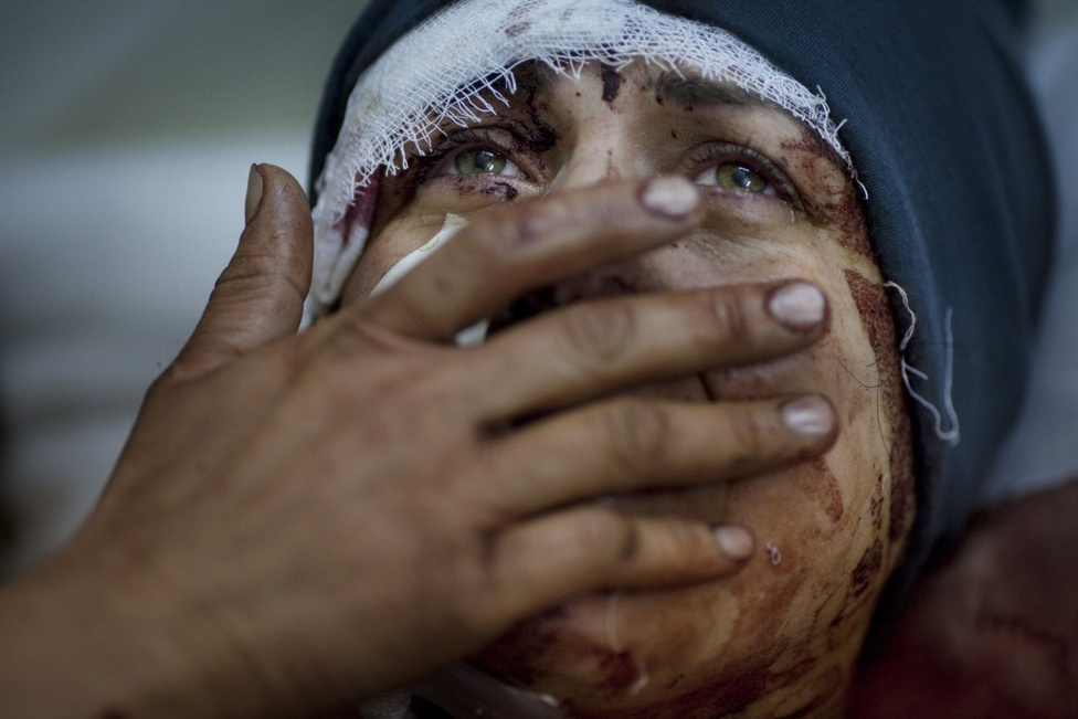 Hír kategória, egyedik - Első hely Egy szíriai nő mutatja sérüléseit, miután házukat eltalálta a Szíriai Hadsereg rakétája. A nő a támadásban elvesztette férjét és két gyermekét.