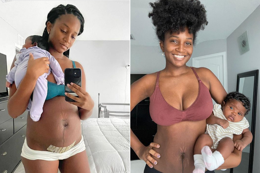 Milyen egy női test a valóságban 1 héttel szülés után? 8 boldog édesanya, aki megmutatta, gyakran mi történik a testtel