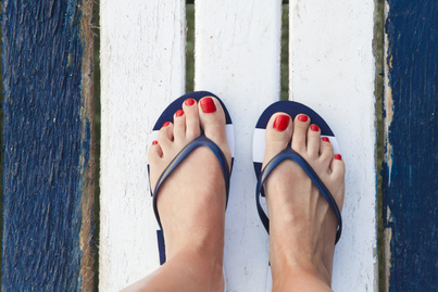 Cukorbetegeknek, lúdtalpasoknak is tiltólistás a flip-flop papucs: sok ember számára káros a népszerű lábbeli