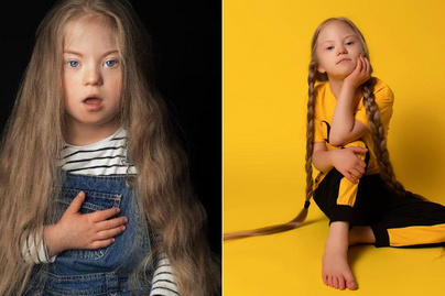 Az orvos lemondott a Down-szindrómás kislányról, Věra már 9 éves, és népszerű modell: sugárzik belőle az életöröm