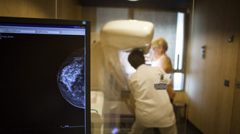 Július óta nincs mammográfiai szűrés az Uzsoki utcai kórházban Budapesten