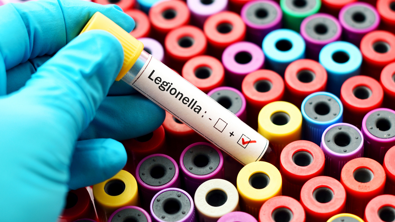 Száraz köhögés, izomfájdalom is jelezheti a legionella-fertőzést: könnyű összetéveszteni az influenzával