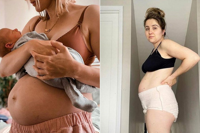 Ilyen egy valódi női test szülés után: filterek és photoshop nélkül is szép a valóság