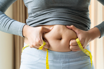 A zsírmáj kialakulásának 4 leggyakoribb oka és kezelése: az étrend is kulcsszereppel bír