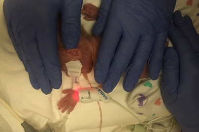 Az orvosok lemondtak a 40 dekával született kisfiúról: ilyen egészséges kissrác lett belőle