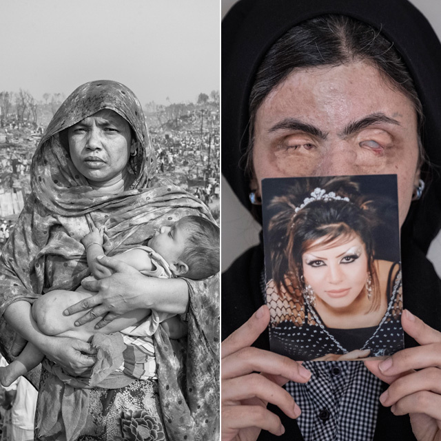 Hontalan édesanya, savtámadást túlélő nő, vizet kereső asszonyok - Megrázó, díjnyertes fotók az emberiségről