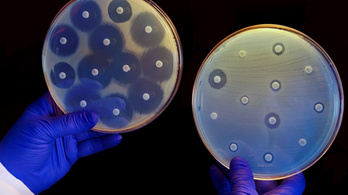 Milliók halálát okozzák az antibiotikumnak is ellenálló fertőzések
