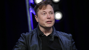 Elon Musk chipet ültetne az emberek agyába