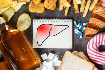 A zsírmáj a cukorbetegség kockázatát is drasztikusan növeli: a genetikai hajlamot is figyelembe kell venni