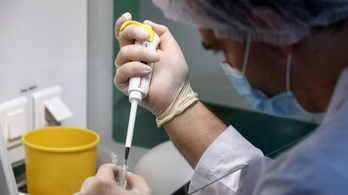 A HIV-vírus egy újabb variánsát fedezték fel Hollandiában
