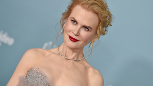 Nicole Kidman címlapfotóján túltolták a retust