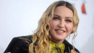 Így nézne ki most Madonna, ha nem botoxoltatott volna