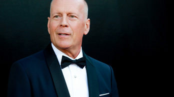 Húsz évvel ezelőtti sérülés vezethetett Bruce Willis betegségéhez
