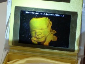 Ultrahanggal készül hologram a bébikről