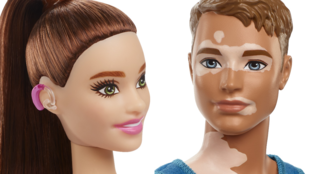 Jön a hallókészülékes Barbie és a vitiligós Ken baba