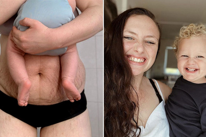 Büszke terhességi striáira az édesanya: filter nélküli képeket oszt meg az Instagramon