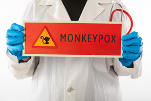 Itt a majomhimlő: minden, amit érdemes tudnod a betegségről
