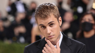 Justin Bieber fél arca lebénult egy vírus miatt, lemondta a koncertjeit