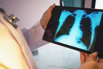 A harmadik leggyakoribb halálokká válhat: a gyakori tüdőbetegség lelassítható odafigyeléssel