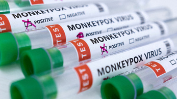 Újabb hat majomhimlő-fertőzöttet diagnosztizáltak Magyarországon