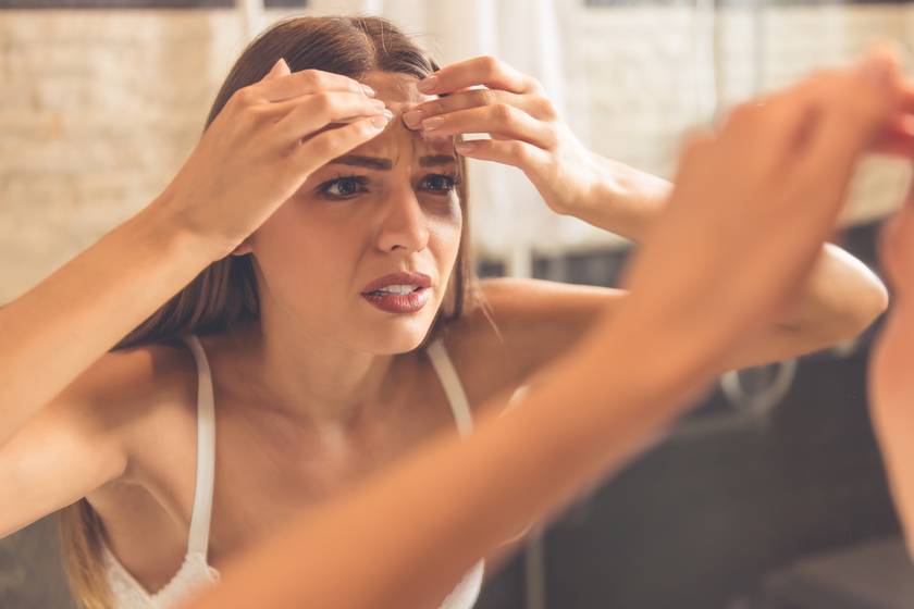 Ha itt jelennek meg pattanások az arcodon, erre a 6 dologra gyanakodj - A hajvonal gyulladásainak legfőbb okai