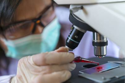 Melyik laboreredmény jelez májbetegséget? 12 érték, ami nagyobb kockázatokra utal