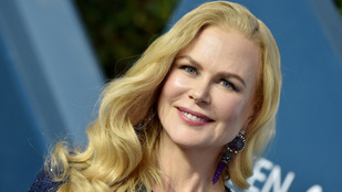 Nicole Kidman durván kigyúrta magát, rá sem lehet ismerni