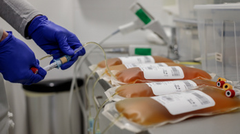 „Az emberek 80 százalékának élete során legalább egyszer szüksége van vérplazmára”