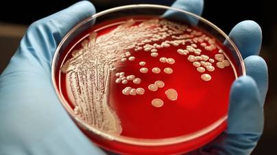 Baktériumokból készít ékszereket ez a lány: nem találod ki, honnan veszi az alapanyagot