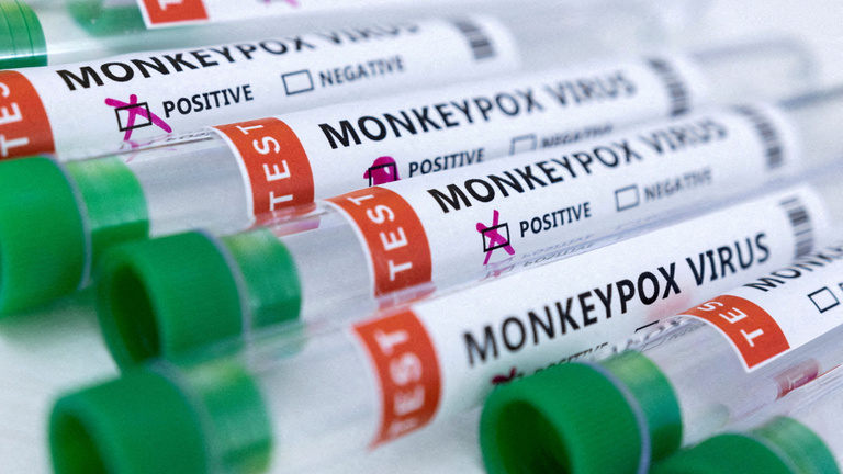 Jóváhagyták az első majomhimlő-antigéntesztet Magyarországon