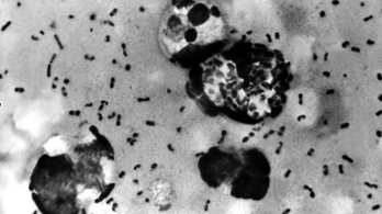 Korabeli pestisáldozatok DNS-ét vizsgálták a kutatók, meglepő felfedezésre jutottak