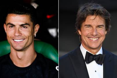Így nézett ki Cristiano Ronaldo és Tom Cruise a műfogsor előtt - 8 sztár, aki megcsináltatta szabálytalan fogait