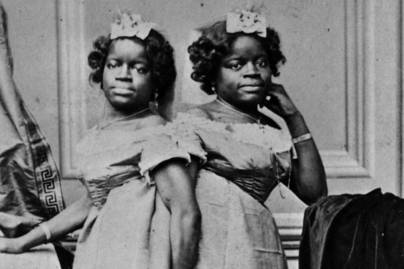 „Kétfejű lányként” mutogatták a sziámi ikerpárt a 19. században - Millie és Christine McKoy története
