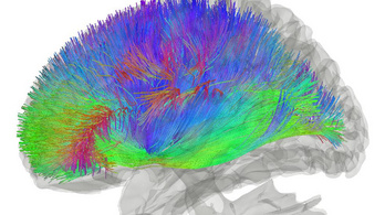 Kulcsfontosságú idegrendszeri működést találtak a Parkinson-kór kutatói